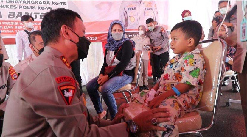 Polda Banten Gelar Operasi Bibir Sumbing